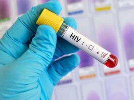 “Date el pinchazo más importante. Hacete el test de VIH»