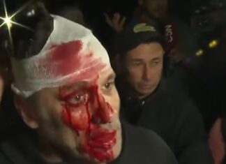 Incidentes en el acto de Milei: botellazo, piedras y golpes