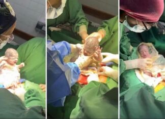 Nacieron trillizas idénticas en Salta: un caso único en un millón