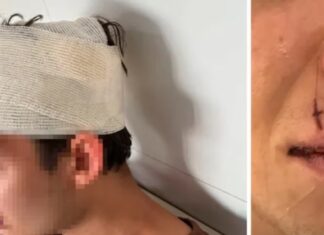 Un joven denunció que fue atacado por rugbiers cordobeses